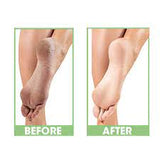 ProLinc - Be Natural - Dry Heel Eliminator